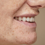 White Spots on Your Teeth? Get Help From a Family Dentist