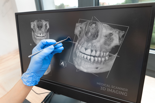 The Importance Of  D Dental Scans